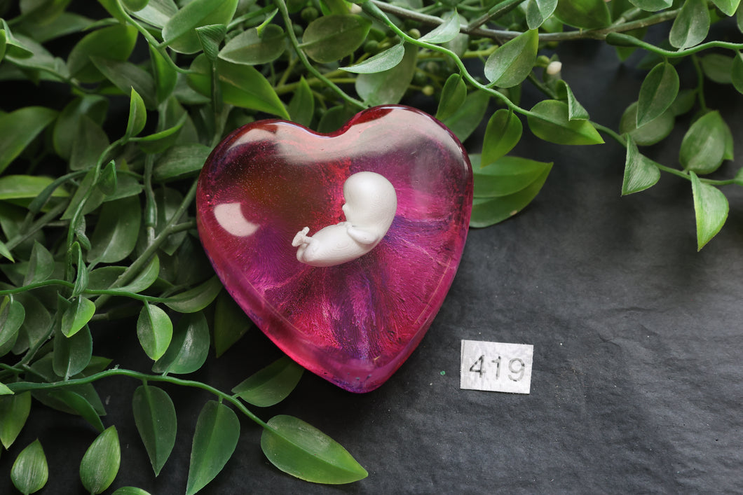 419 | 10 weeks